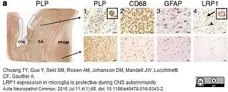 Anti Myelin Proteolipid Protein Antibody, clone plpc1 gallery image 8