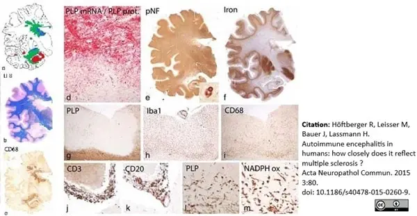 Anti Myelin Proteolipid Protein Antibody, clone plpc1 gallery image 9