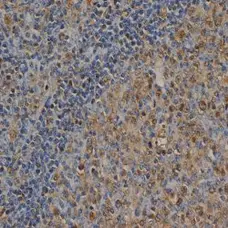 Anti Ubiquitin Antibody, clone 1B4-UB gallery image 1