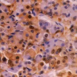 Anti Ubiquitin Antibody, clone 1B4-UB gallery image 2