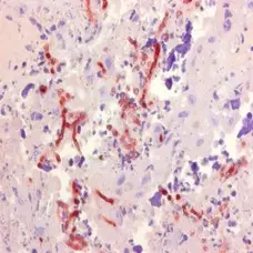 Anti Aspergillus SPP Antibody, clone WF-AF-1 gallery image 1