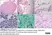 Anti Aspergillus SPP Antibody, clone WF-AF-1 thumbnail image 3