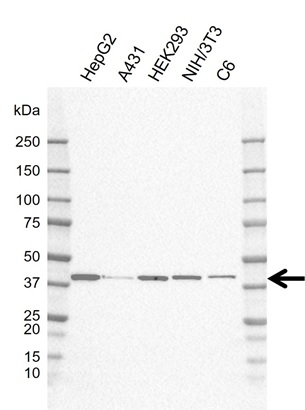 Anti ACAT1 Antibody, clone AB02/4H6 (PrecisionAb Monoclonal Antibody) gallery image 1