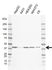 Anti ACAT1 Antibody, clone AB02/4H6 (PrecisionAb Monoclonal Antibody) thumbnail image 1