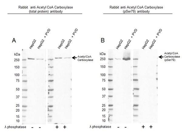 Anti Acetyl Coa Carboxylase (pSer79) Antibody, clone RM270 (PrecisionAb Monoclonal Antibody) gallery image 3