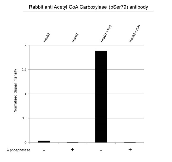 Anti Acetyl Coa Carboxylase (pSer79) Antibody, clone RM270 (PrecisionAb Monoclonal Antibody) gallery image 4