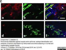 Anti Human Actin Alpha (Smooth Muscle) Antibody, clone 1A4 gallery image 1