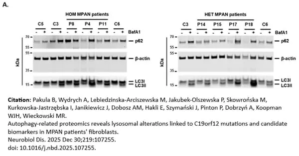ANTI-ACTIN hFAB™ Rhodamine Antibody Antibody, clone AbD22606 gallery image 11