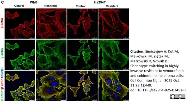 Anti Human Actin Beta Antibody, clone 4C2 gallery image 14