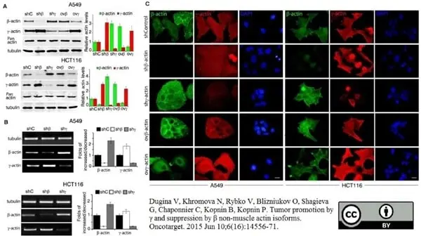 Anti Human Actin Beta Antibody, clone 4C2 gallery image 2