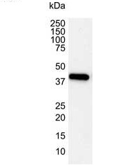 Anti Human Actin Beta Antibody, clone 4C2 gallery image 9