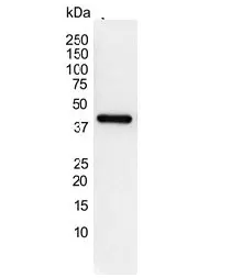 Anti Human Actin Gamma Antibody, clone 2A3 (Monoclonal Antibody Antibody) gallery image 10