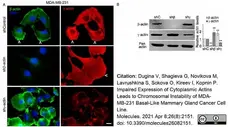 Anti Human Actin Gamma Antibody, clone 2A3 (Monoclonal Antibody Antibody) gallery image 11