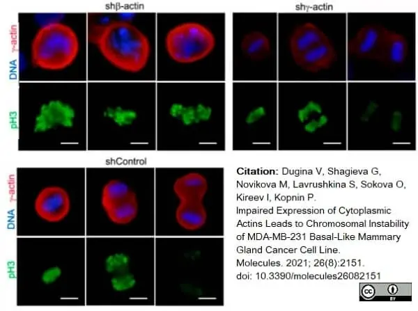 Anti Human Actin Gamma Antibody, clone 2A3 (Monoclonal Antibody Antibody) gallery image 12