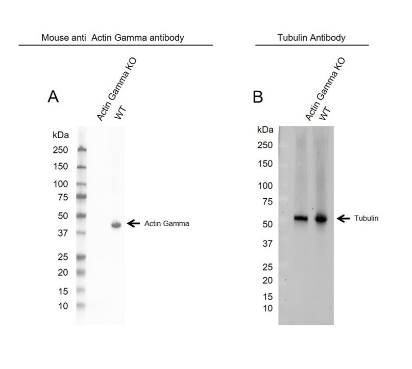 Anti Human Actin Gamma Antibody, clone 2A3 (Monoclonal Antibody Antibody) gallery image 14