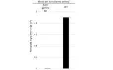 Anti Human Actin Gamma Antibody, clone 2A3 (Monoclonal Antibody Antibody) gallery image 15