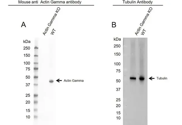 Anti Human Actin Gamma Antibody, clone 2A3 (Monoclonal Antibody Antibody) gallery image 17