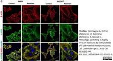 Anti Human Actin Gamma Antibody, clone 2A3 (Monoclonal Antibody Antibody) gallery image 21