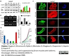 Anti Human Actin Gamma Antibody, clone 2A3 (Monoclonal Antibody Antibody) gallery image 3