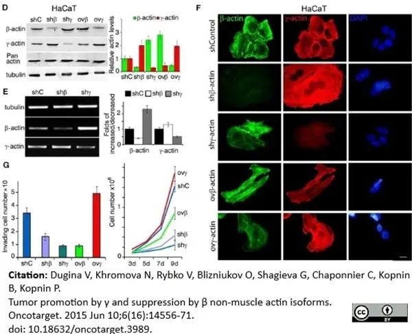 Anti Human Actin Gamma Antibody, clone 2A3 (Monoclonal Antibody Antibody) gallery image 3