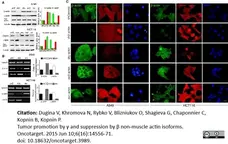 Anti Human Actin Gamma Antibody, clone 2A3 (Monoclonal Antibody Antibody) gallery image 4