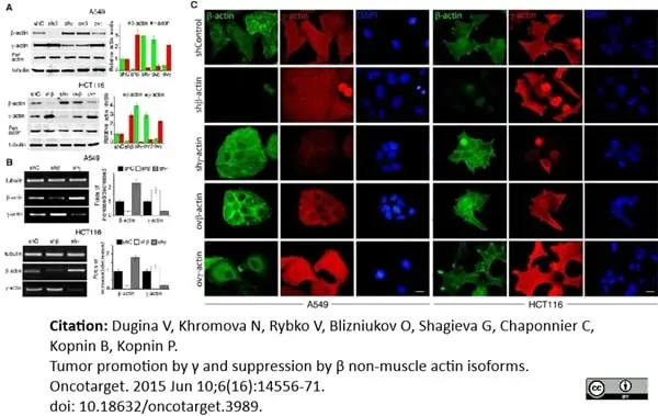 Anti Human Actin Gamma Antibody, clone 2A3 (Monoclonal Antibody Antibody) gallery image 4