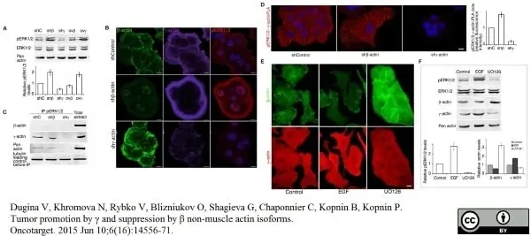 Anti Human Actin Gamma Antibody, clone 2A3 (Monoclonal Antibody Antibody) gallery image 6