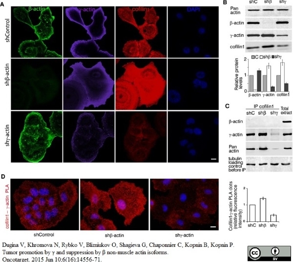 Anti Human Actin Gamma Antibody, clone 2A3 (Monoclonal Antibody Antibody) gallery image 7