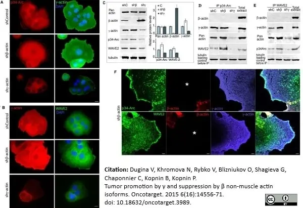 Anti Human Actin Gamma Antibody, clone 2A3 (Monoclonal Antibody Antibody) gallery image 7