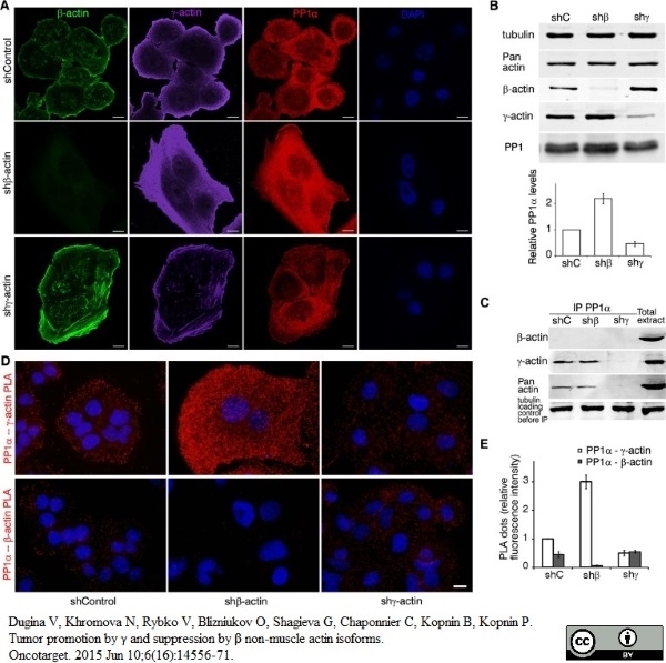 Anti Human Actin Gamma Antibody, clone 2A3 (Monoclonal Antibody Antibody) thumbnail image 8