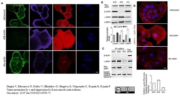 Anti Human Actin Gamma Antibody, clone 2A3 (Monoclonal Antibody Antibody) gallery image 8