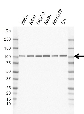 Anti ACTININ-1 Antibody, clone rAB01-3G11 (PrecisionAb Monoclonal Antibody) gallery image 1