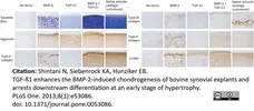 Anti Human Aggrecan Antibody, clone 7D4 gallery image 2