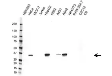 Anti AKR1C1 Antibody, clone CPTC4 (PrecisionAb Monoclonal Antibody) gallery image 1