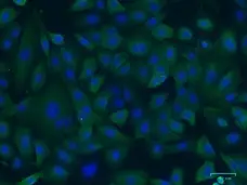 Anti AKR1C1 Antibody, clone CPTC4 (PrecisionAb Monoclonal Antibody) gallery image 2