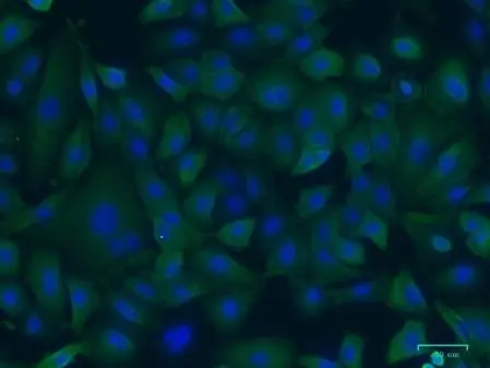 Anti AKR1C1 Antibody, clone CPTC4 (PrecisionAb Monoclonal Antibody) gallery image 2