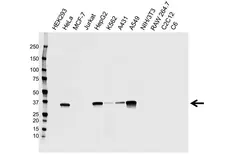 Anti AKR1C2 Antibody, clone CPTC13 (PrecisionAb Monoclonal Antibody) gallery image 1