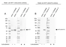 Anti Akt (pSer473) Antibody, clone RM251 (PrecisionAb Monoclonal Antibody) gallery image 3