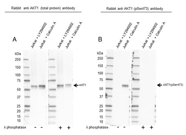 Anti Akt (pSer473) Antibody, clone RM251 (PrecisionAb Monoclonal Antibody) gallery image 3