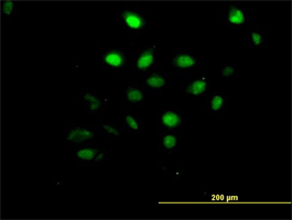 Anti Human AKT1 Antibody, clone 6F11 thumbnail image 2