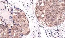 Anti AKT1 Antibody, clone RM252 gallery image 2