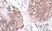 Anti AKT1 Antibody, clone RM252 thumbnail image 2