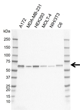 Anti AKT3 Antibody, clone I02/2H9 (PrecisionAb Monoclonal Antibody) gallery image 1