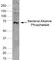 Anti Human Alkaline Phosphatase Antibody, clone BGN/03/662 thumbnail image 1