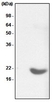 Anti Human Alpha B Crystallin Antibody, clone 2E8 thumbnail image 1