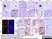 Anti Human AMH Antibody, clone 5/6 thumbnail image 1