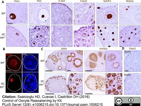Anti Human AMH Antibody, clone 5/6 gallery image 2