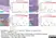 Anti Human AMH Antibody, clone 5/6 thumbnail image 4