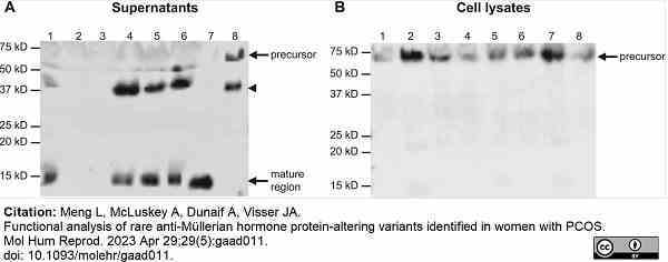 Anti Human AMH Antibody, clone 5/6 thumbnail image 6