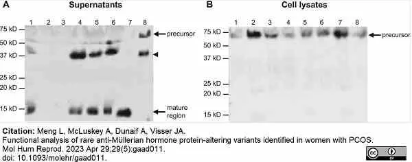 Anti Human AMH Antibody, clone 5/6 gallery image 6